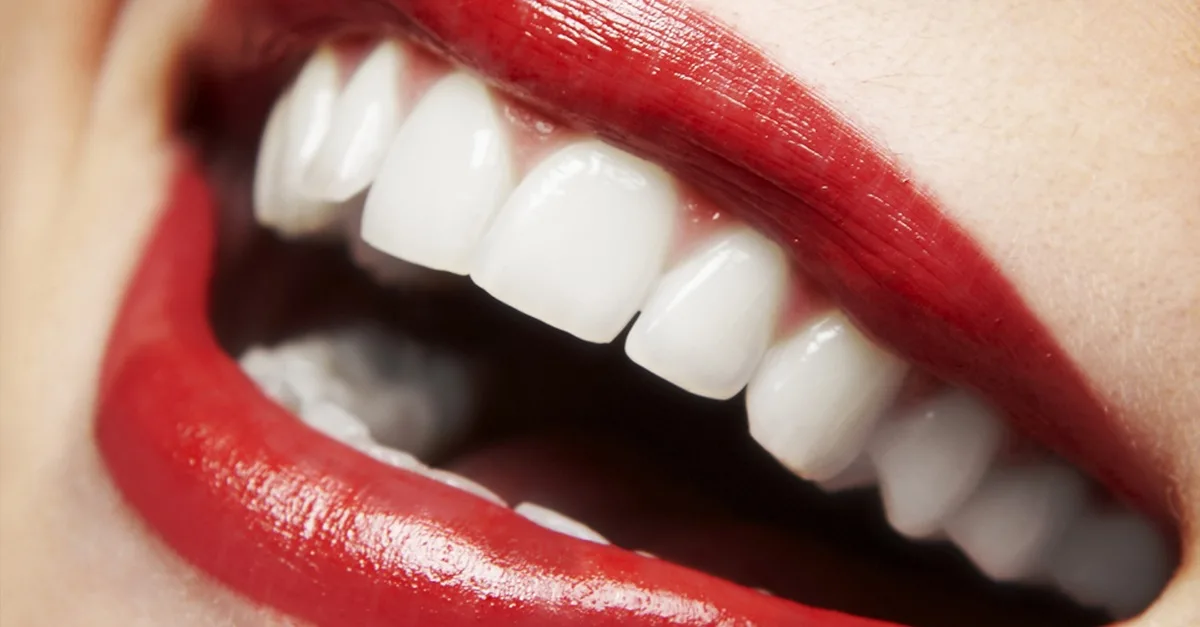 Dental Check-up With Optional Stain Removal, Or Laser Teeth Whitening in Dubai | Dubai Travel Tours Dental Check-up With Optional Stain Removal